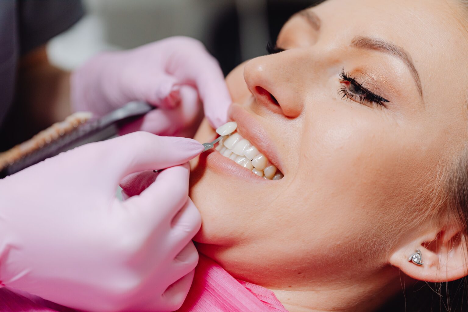 The Benefits of Porcelain Veneers for a Healthier-Looking Smile
